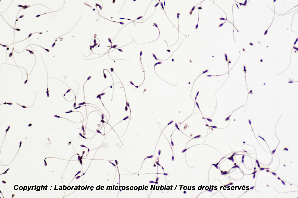 Spermatozoïdes - Homme - H - Nublat